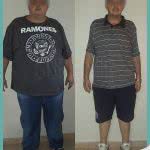 Hombre Antes y Despues de una Cirugia Bariatrica