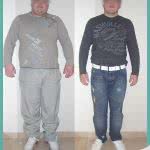 Balon Gastrico, Antes y Despues