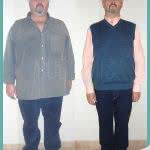 Bypass Gastrico en Hombres Antes y Despues