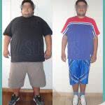 Resultados Bypass Gastrico